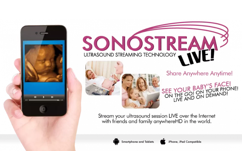 sonostream ultrasound streaming technology