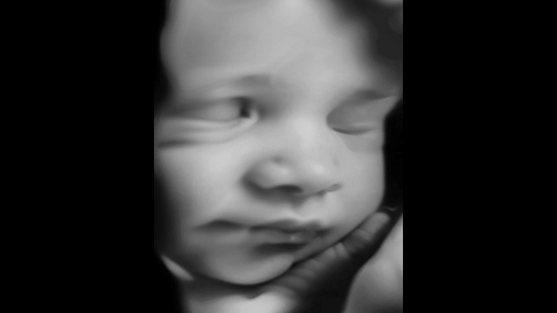 2D baby ultrasound